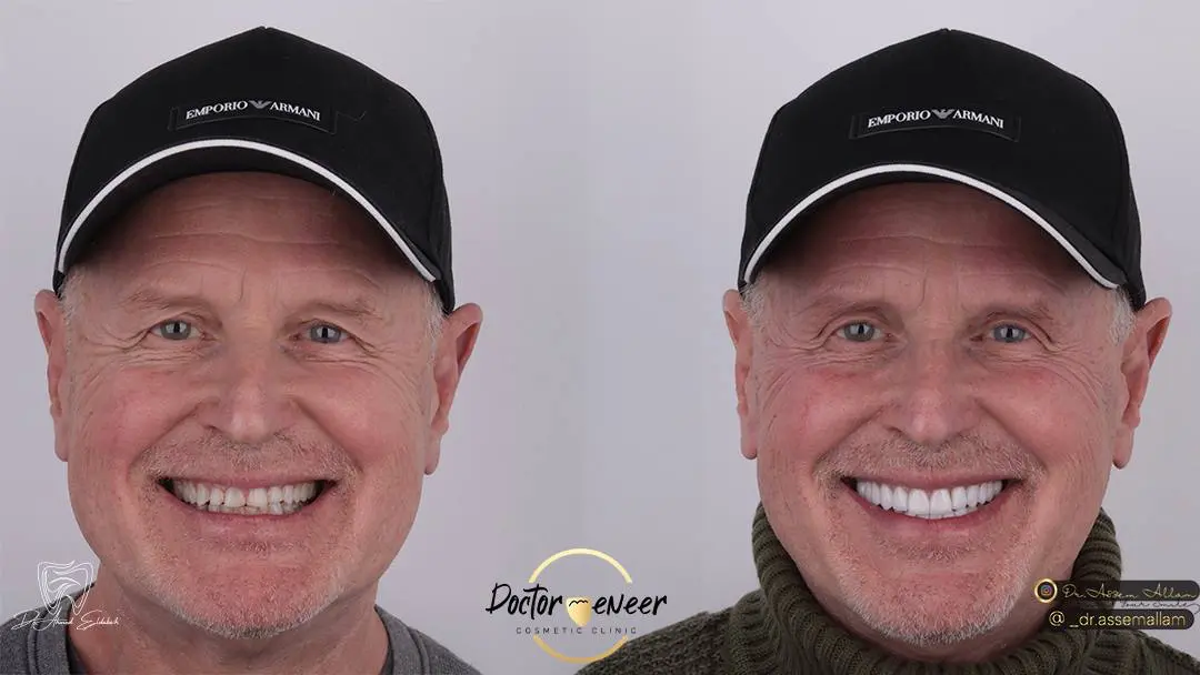 Jed Before and After